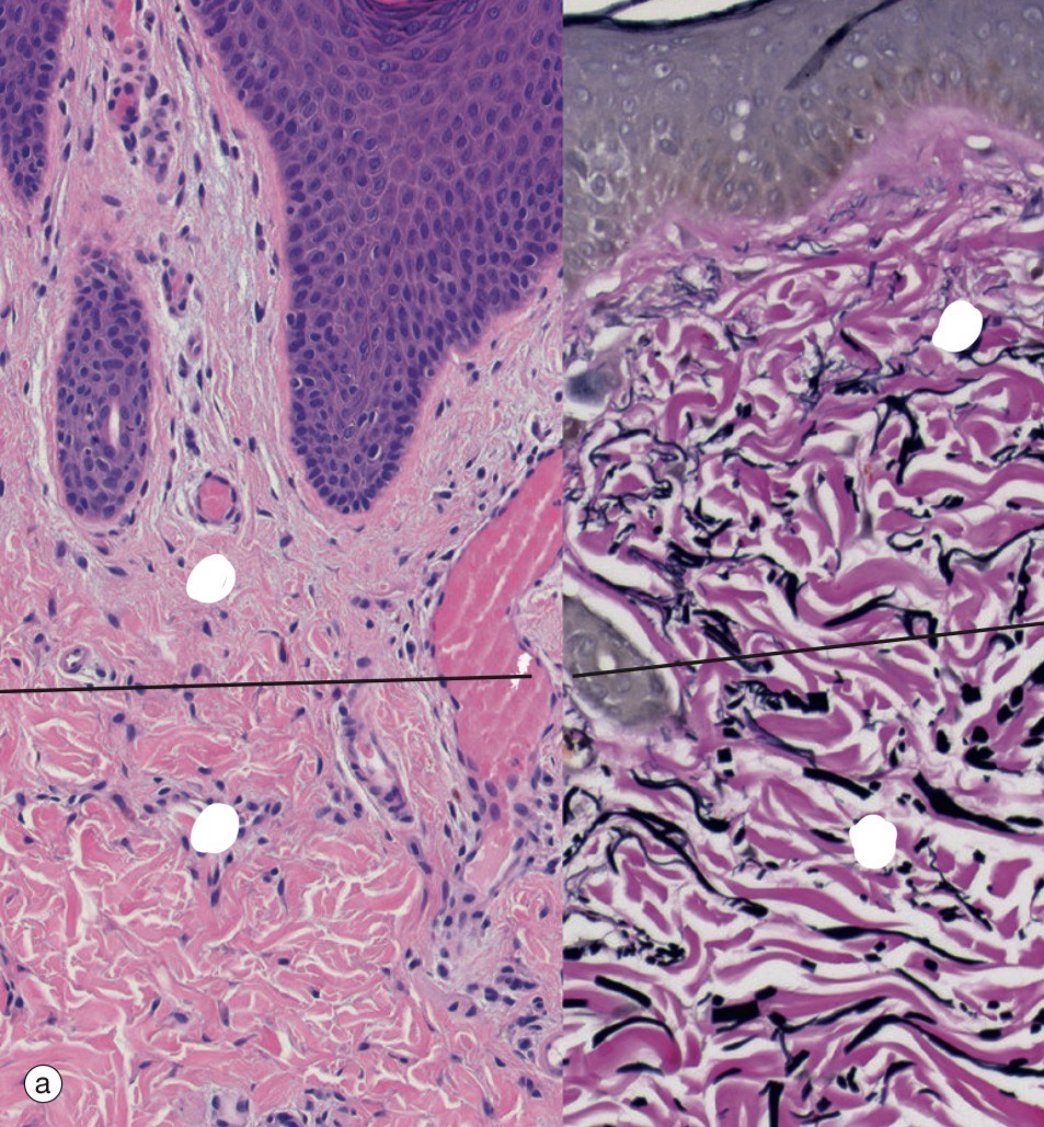 <p>Identify the top vs bottom layer?</p>