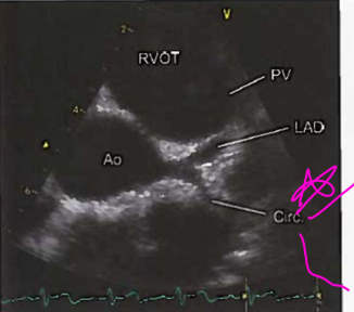 <p>circ always circles the LA</p>