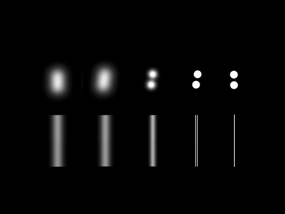 <ul><li><p>Refractive amblyopia: Vernier acuity loss is closely related to resolution acuity loss</p></li><li><p>Strabismic amblyopia: Vernier acuity loss is much greater than resolution acuity loss, reflecting a disproportionate deficit in positional processing</p></li></ul><p></p>