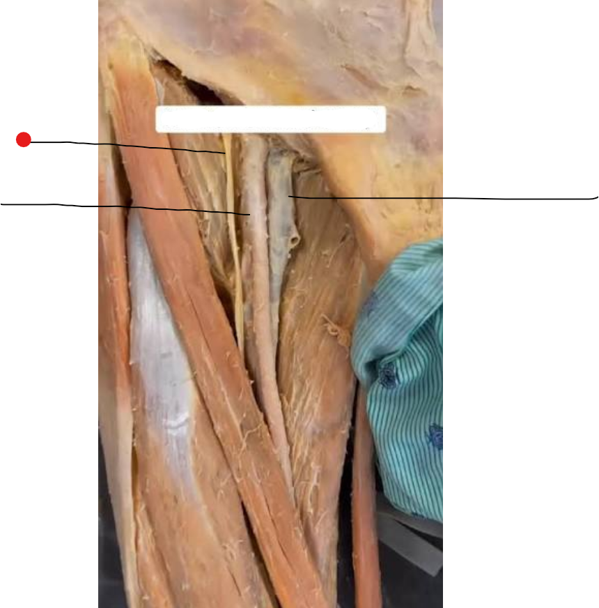 <p>Identify the structure pinned</p>