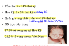 <p>thai kì</p>