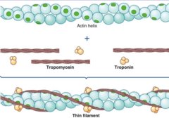 <p>troponin T</p>