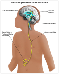 <p>Eval:</p><p>- US and CT</p><p>- Regular head circumference measurements</p><p>Tx: Shunt</p>