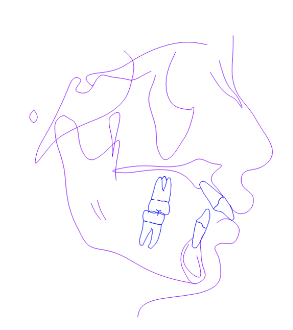 <p><span>This patient's profile is:</span></p>