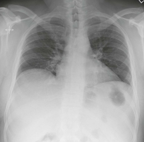 <p>AP Chest: Is this Image Good?</p>
