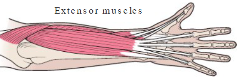 <p><strong>Definition</strong></p><ul><li><p>Painful disorder of fingers — injury of extensor muscles of thumb and fingers </p></li></ul><p></p><p><strong>Causes</strong></p><ul><li><p>Extending fingers independently of each other </p></li></ul><p></p><p><strong>Symptoms</strong></p><ul><li><p>Numbness, pain, loss of strength in fingers </p></li></ul><p></p>