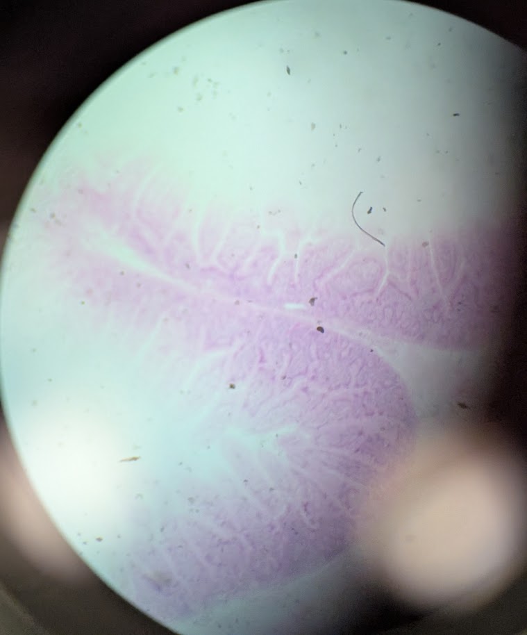 <p>Where in the body is this</p>