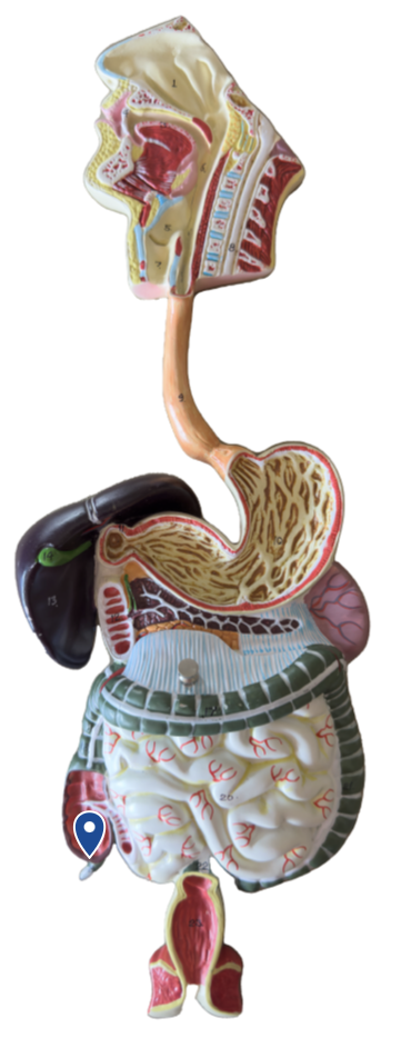 <p>Name this segment of the large intestine.</p>