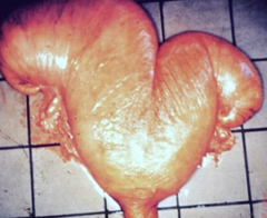 <p>What is the pathophysiology of bovine pyometra?</p>
