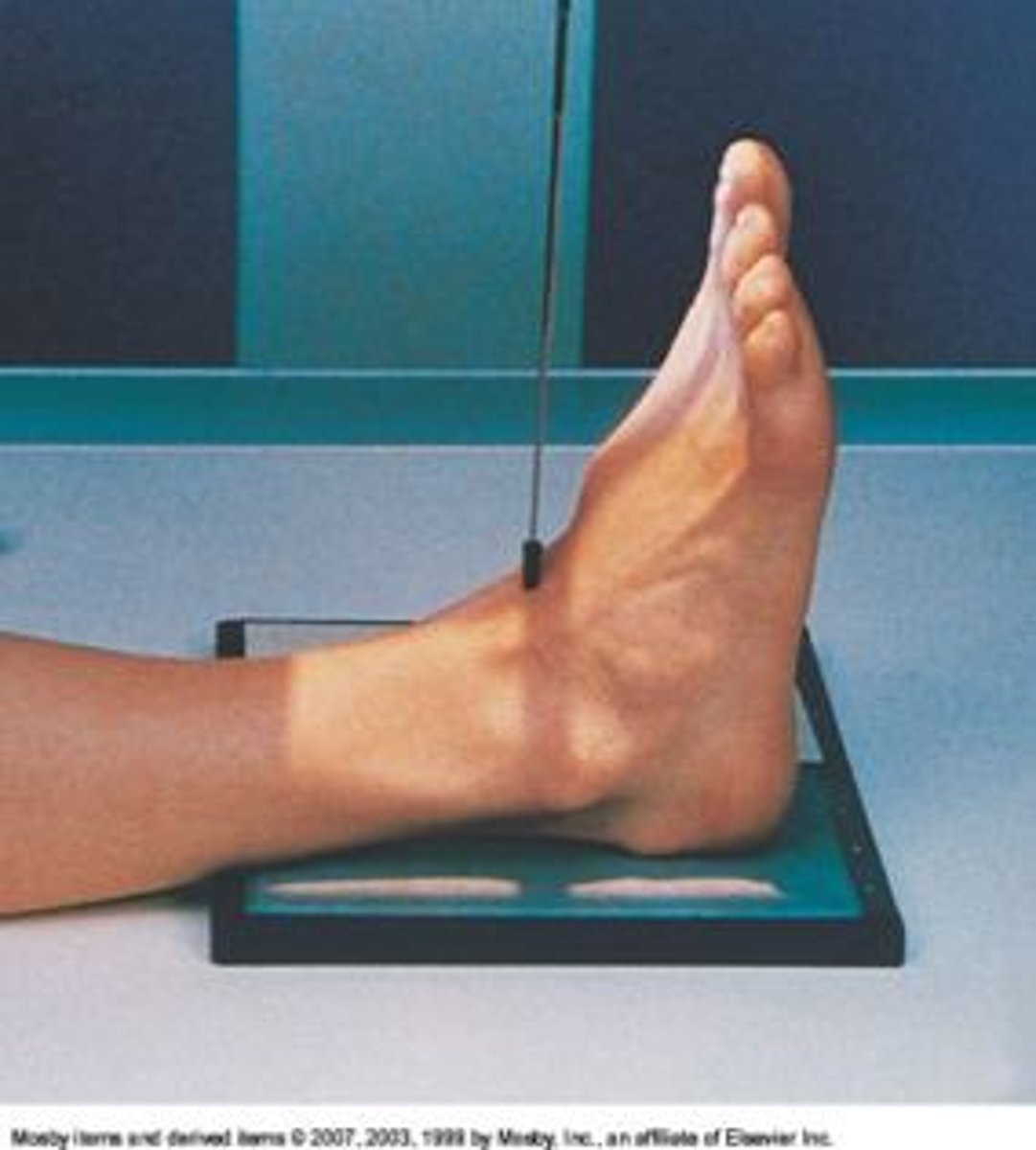 <p>S - on lap</p><p>T - 5 mAs @ 60 kVp</p><p>A - none</p><p>M - correct foot, on cassette</p><p>P - dorsiflex foot, CR between malleoli</p><p>S - 40"</p><p>B - hold</p><p>C - 10 x 12, C</p>