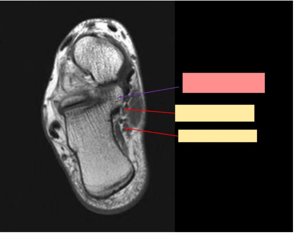<p>Identify the structure </p>