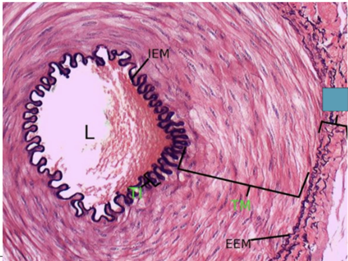 <p>Identify the layer of the vessel</p>