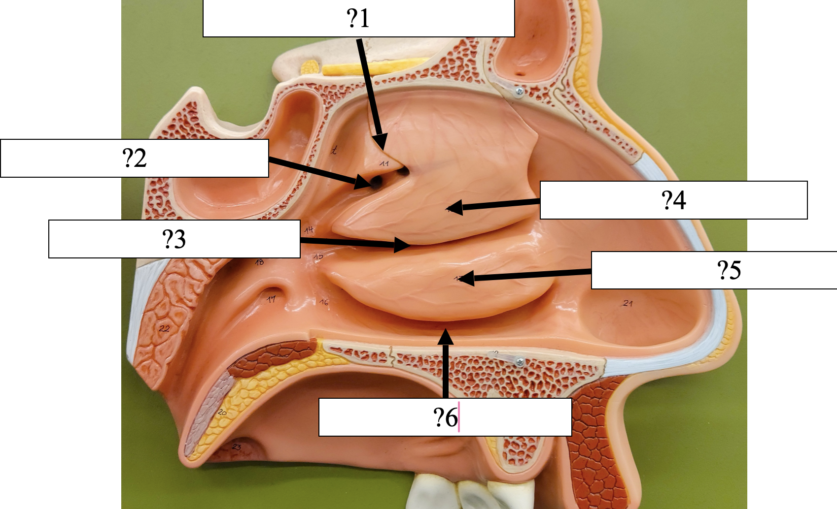 <p>2 Name the groove?</p>