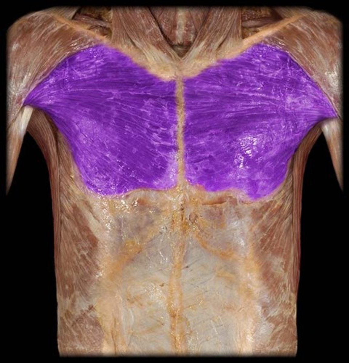 <p>shoulder flexion, medial rotation, and adduction</p>