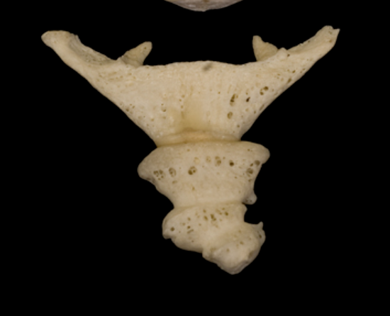 <p>anterior view</p>