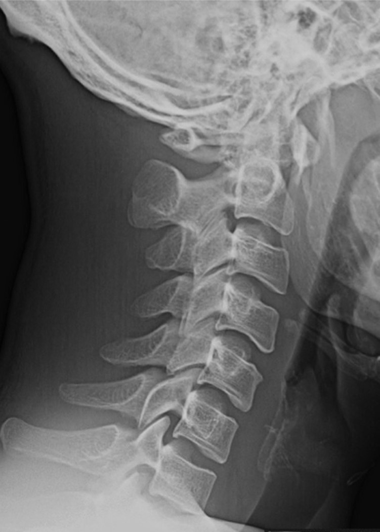 <p>What is the finding and diagnosis?</p>