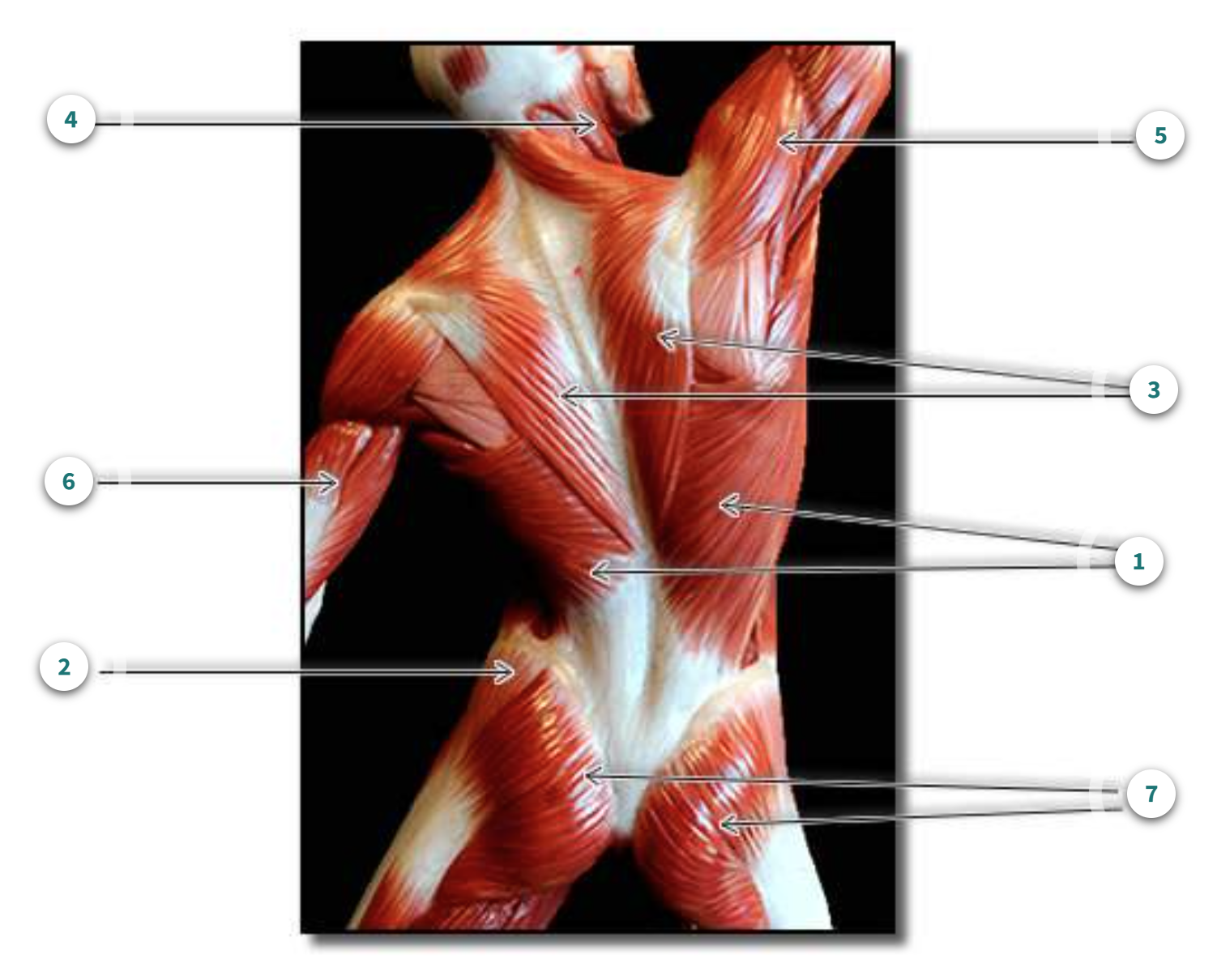 <p>What muscle is number 4?</p>
