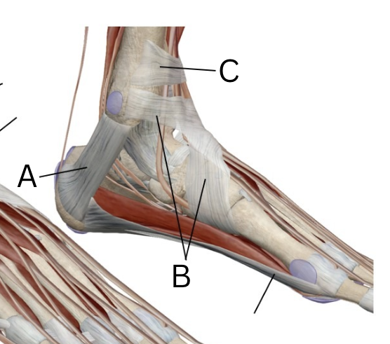 <p>Label these retinaculum? medial or lateral?</p>
