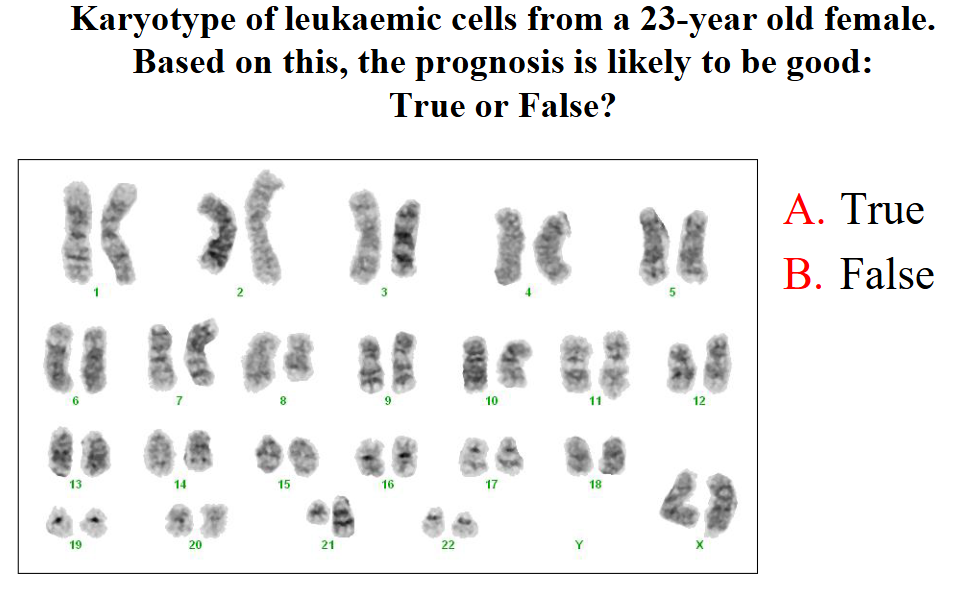 <p>Karyotype of leukaemic cells from a 23-year old female. Based on this, the prognosis is likely to be good:True or False?</p>