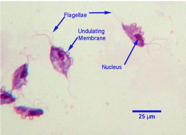 <p>MCQ: Several cows on a farm were aborting and vaginal swabs were taken for cultures. What was the parasite identified?</p>