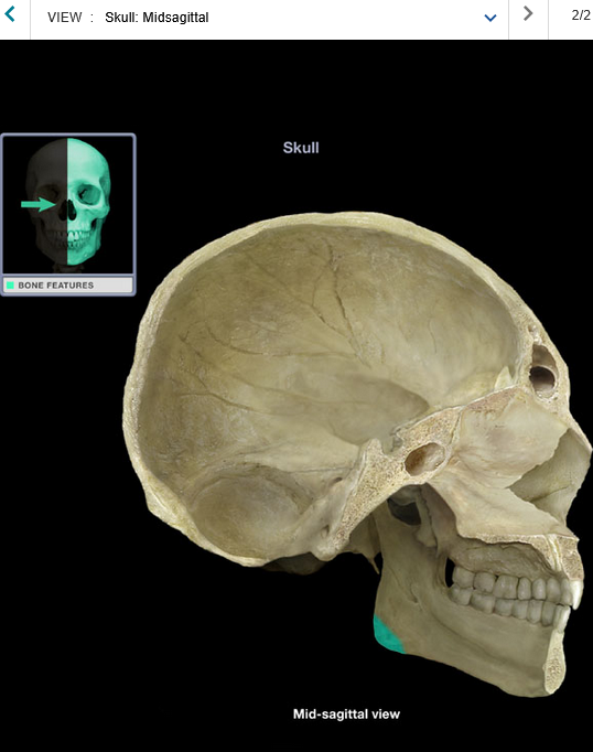 <p>Angle of mandible</p>