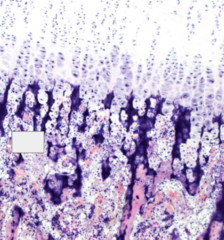<p>matrix is being calcified and serves as a scaffold for new bone</p>
