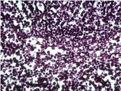 <p>• Mesh of short intertwining fibers and fibroblasts</p><p>• Supportive framework for lymphatic organs</p><p>• Lymph nodes and spleen</p>