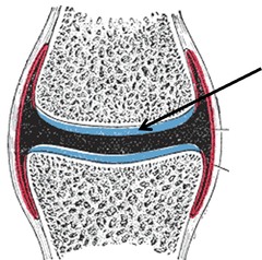 <p>Flexible connective tissue that supports and protects bones by covering its surface so that they can move against each other.</p>