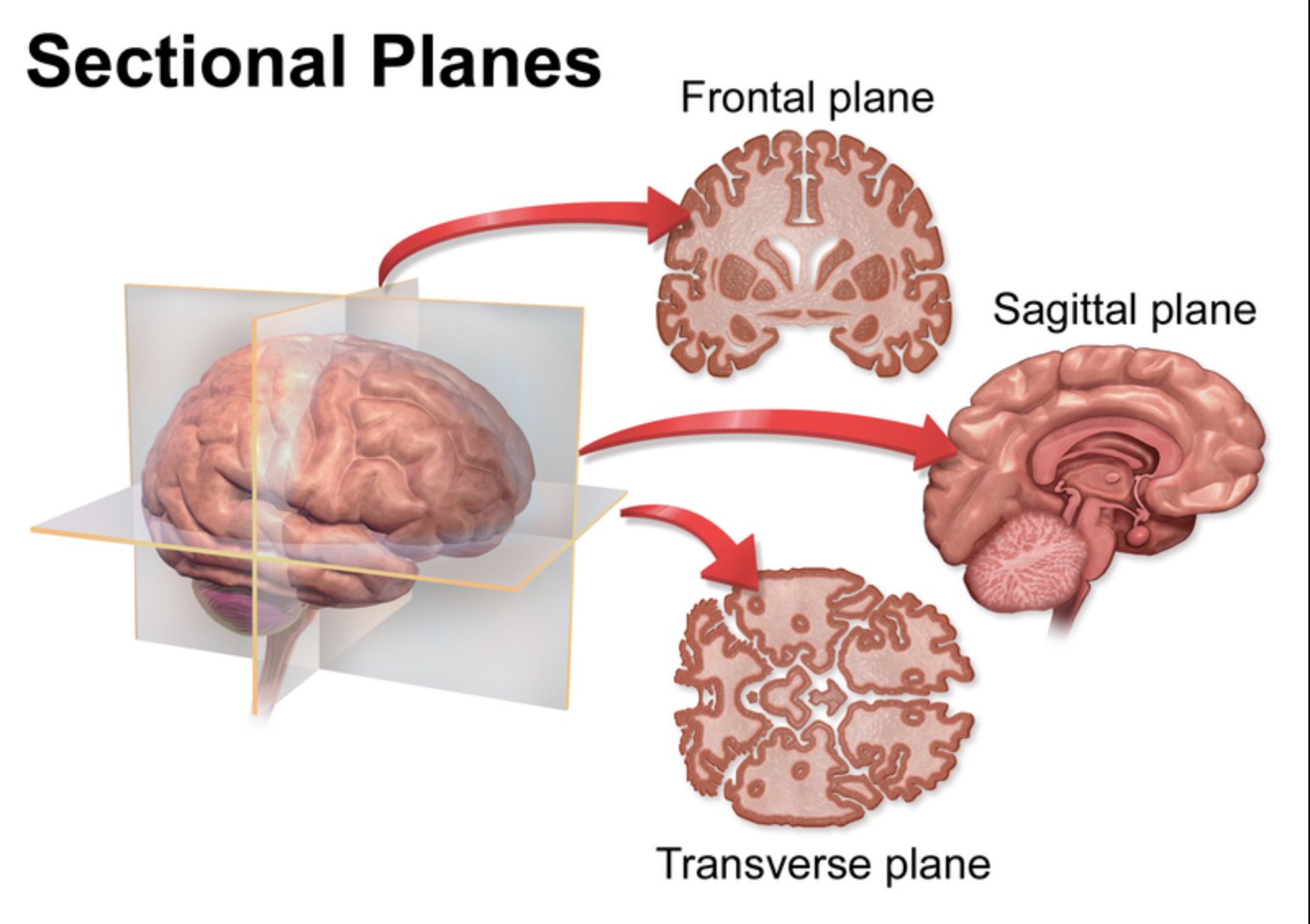 <p>What are the 3 main sections of the brain?</p>
