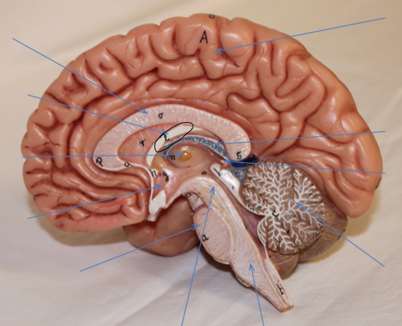<p>Identify the circled area?</p>
