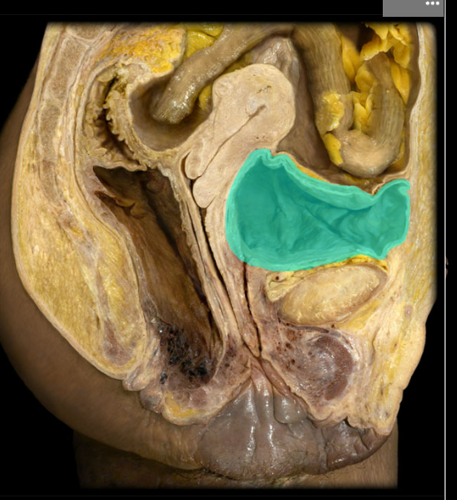<p><span>Urinary bladder</span></p>