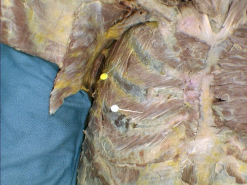 <p>Innervation of the pinned muscles </p>