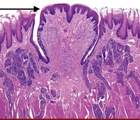 <p>What type of epithelium is this arrow pointing to?</p>