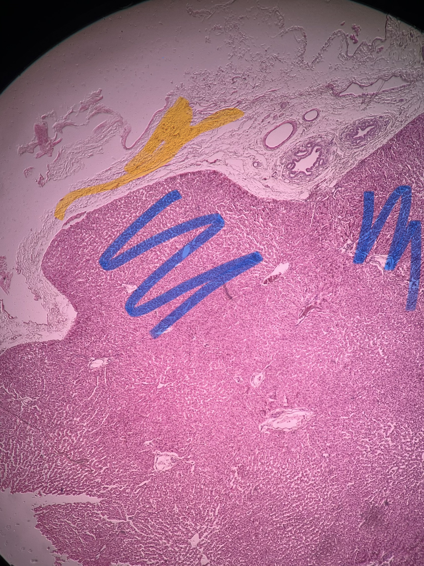 <p>Functional cells of the tissue, make up the majority of a sample (blue)</p>