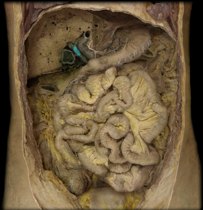 term image