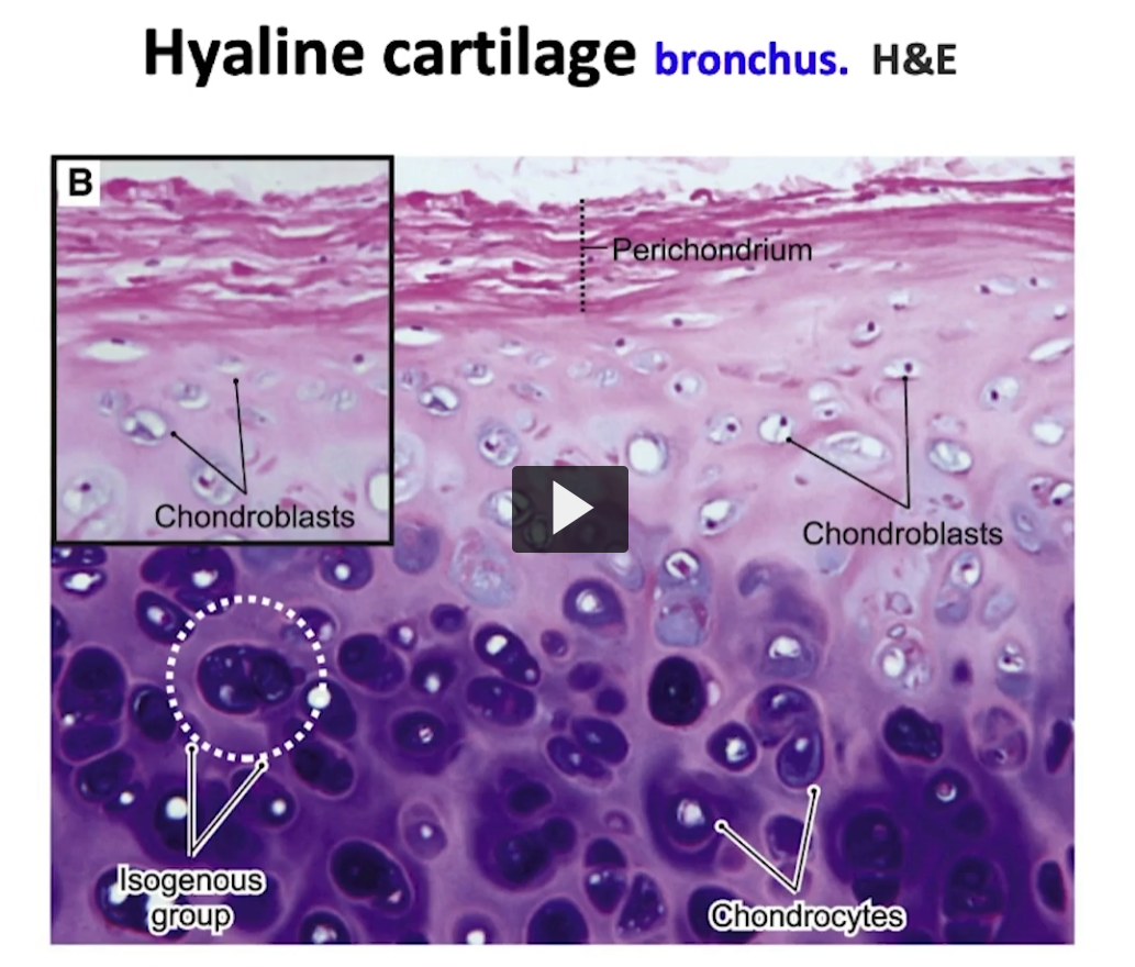 <p>In the same way, in the second image already identified, we can review the components of the hyaline cartilage. </p><p>We have the perichondrium (it’s labeled on the image), chondroblasts that form part of the chondrogenic layer, (it’s labeled on the image), over here we have mature chondrocytes as part of the mature hyaline cartilage (outlined in white at the bottom), isogenous groups, observe the territatorial matrix covering the areas close to those chondrocytes and between them the interterritorial matrix. </p><p>If I increase the magnification of this mature cartilage tissue to observe those chondrocytes, we can appreciate the following. </p>