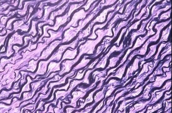 <p>purple squiggly lines that are tightly packed </p>