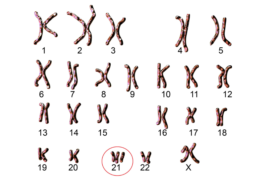 <p>one missing chromosome or one extra chromosome</p>