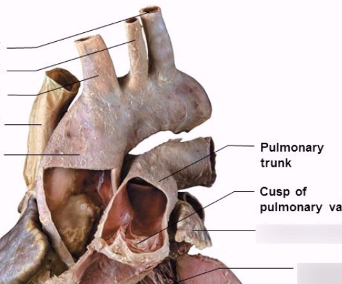 <p>Largest whole structure- with tubes</p><p>leaves left ventricle</p>