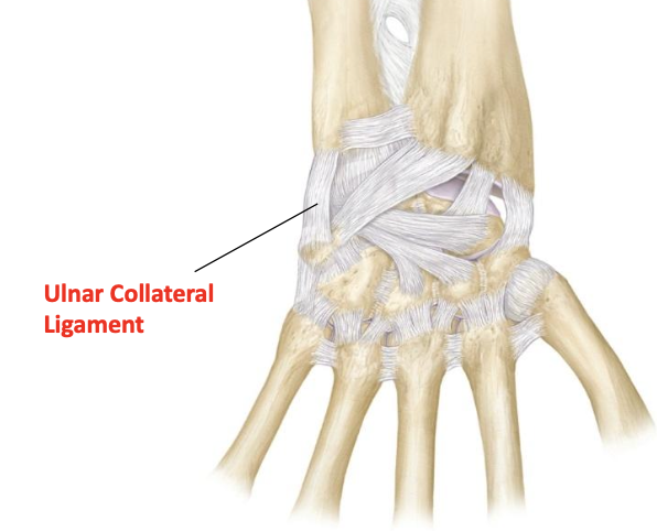 <p>Ulnar collateral ligament (radiocarpal)</p>
