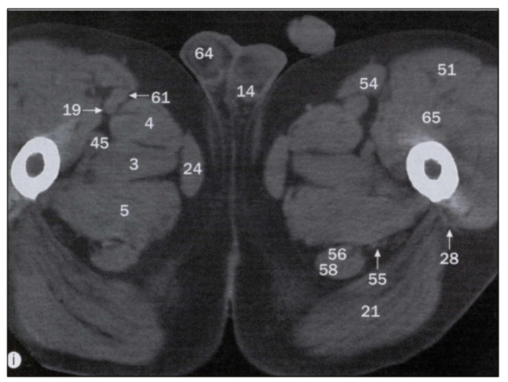 term image