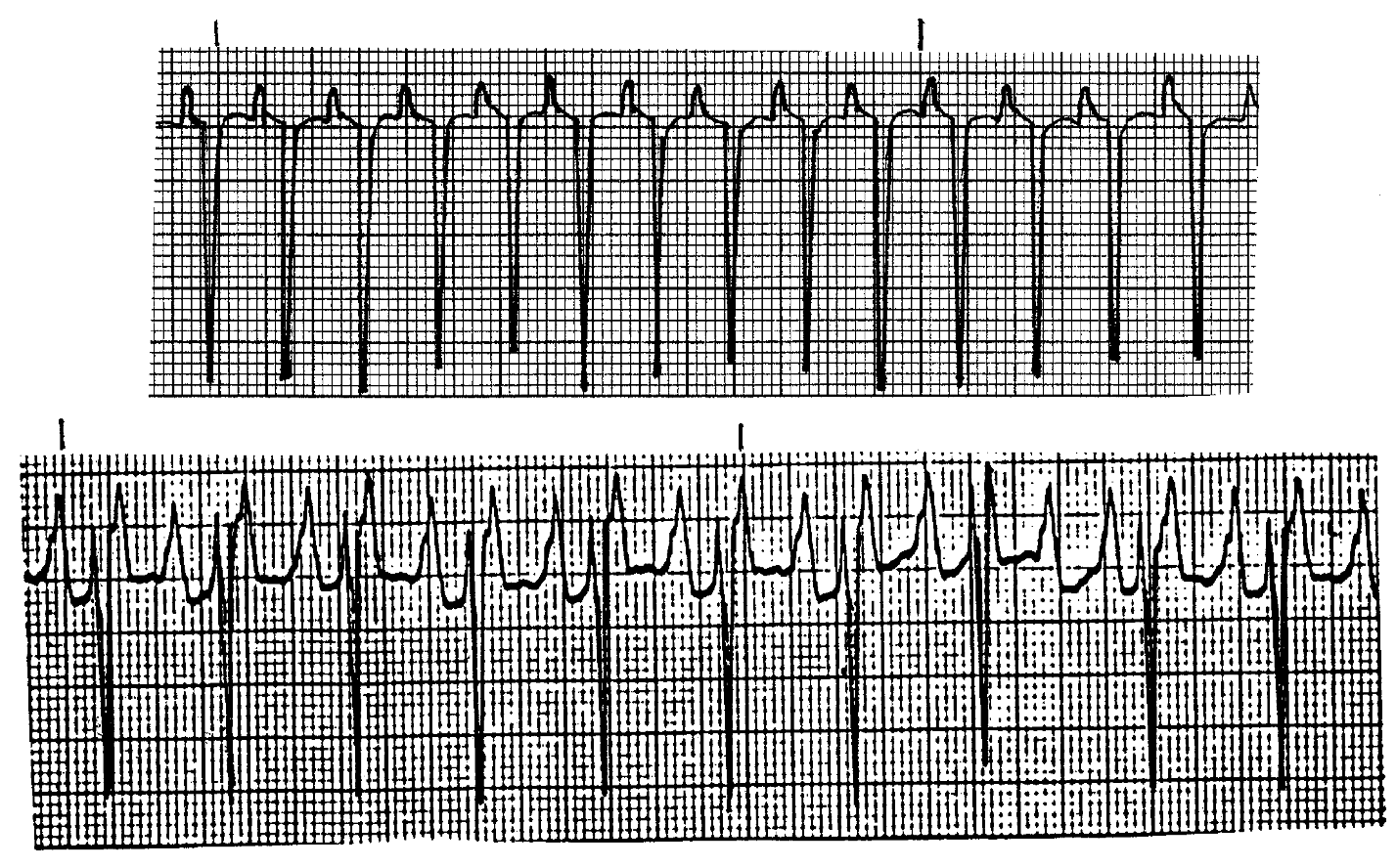 <p>What ECGS are this? </p>