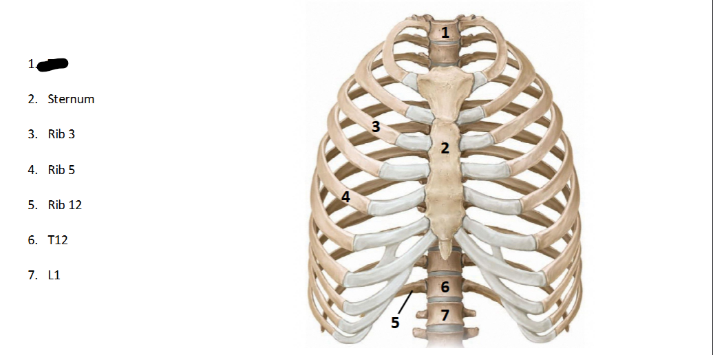 <p>What structure is this within the <strong>Spine? (ANTERIOR OF AXIAL)</strong></p>