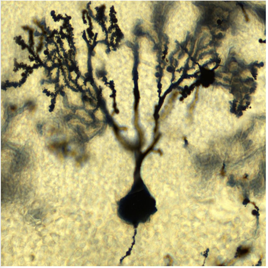 <p>• Location is in the cerebellum.</p><p>• Master coordinator of voluntary movement, balance, motor learning</p>