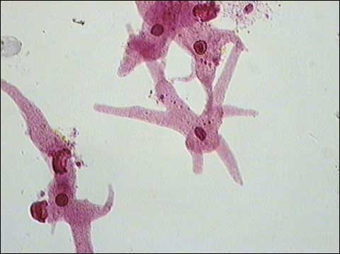 <p>What cell slide is this, and is it a prokaryote?</p>
