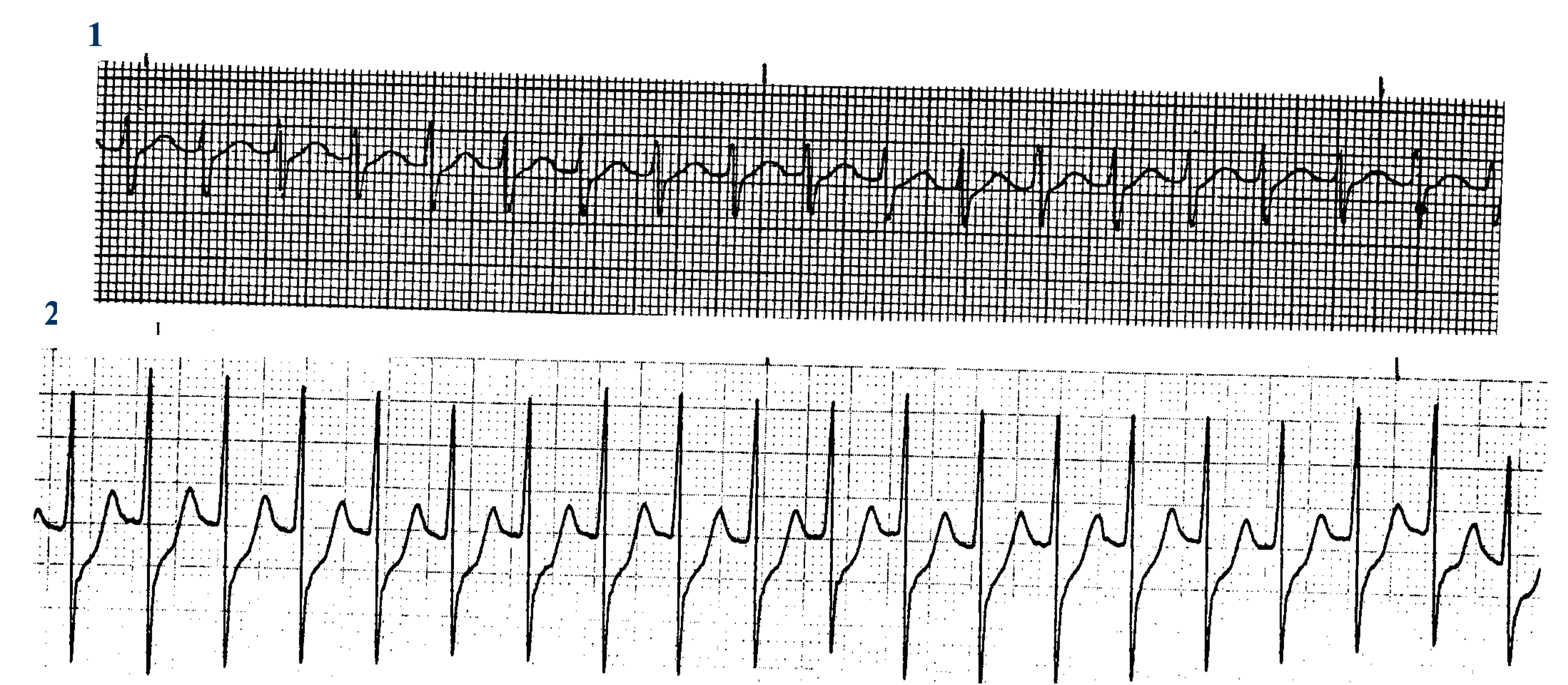 <p>What ECGs are this? </p>