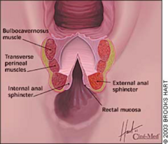 <p>◦1st degree - vaginal epithelium or perineal skin</p><p>◦2nd degree - subepithelium of vagina/perineum with or without involving muscles of perineum</p><p>◦3rd degree - involves anal sphincter</p><p>◦4th degree - involves rectal mucosa</p><p>◦Cervical lacerations</p>