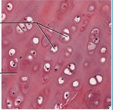 <p>NTK: what type of cartilage is this</p>