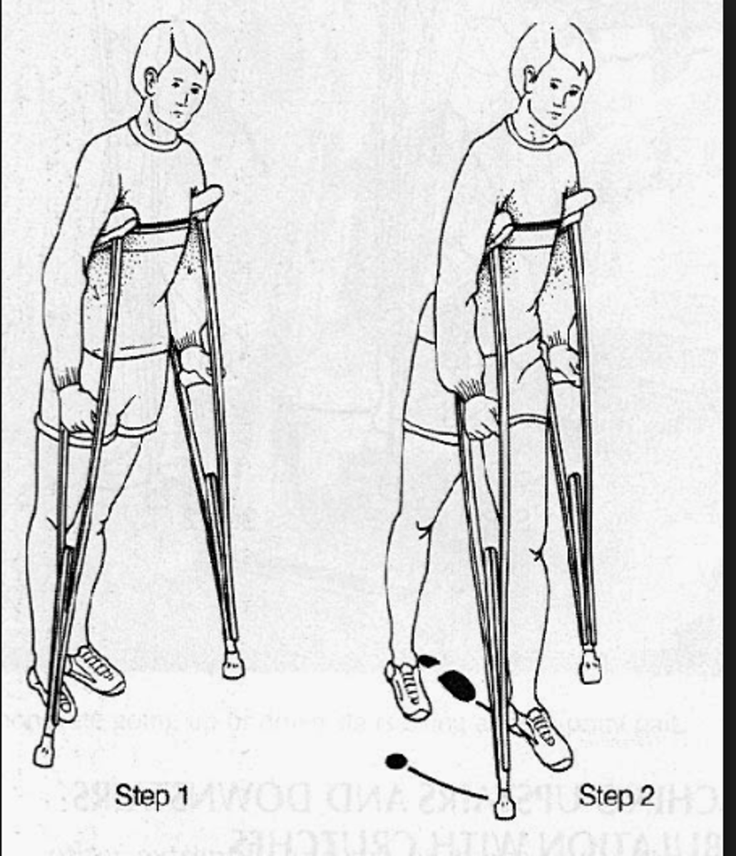 <p>two points of contact; AD and stronger LE advance together</p>