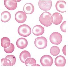 <p>CODOCYTES / LEPTOCYTES</p>